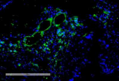 Immunohistochemistry: VPS35 Antibody (11H10) [NBP2-78827]