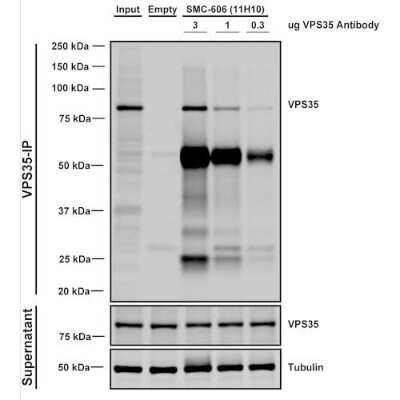 Immunoprecipitation: VPS35 Antibody (11H10) [NBP2-78827]