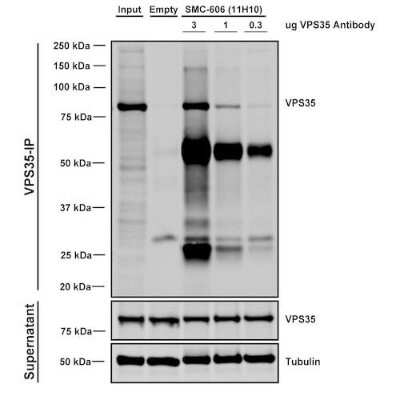 Immunoprecipitation: VPS35 Antibody (11H10) [NBP2-78827]