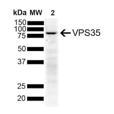 Western Blot: VPS35 Antibody (11H10) [NBP2-78827]