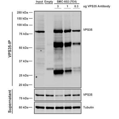 Immunoprecipitation: VPS35 Antibody (7E4) [NBP2-78823]