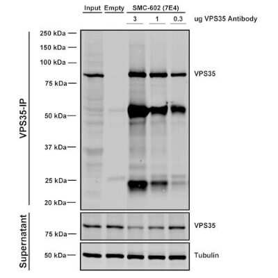 Immunoprecipitation: VPS35 Antibody (7E4) [NBP2-78823]