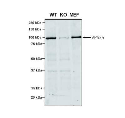 Western Blot: VPS35 Antibody (7E4) [NBP2-78823]