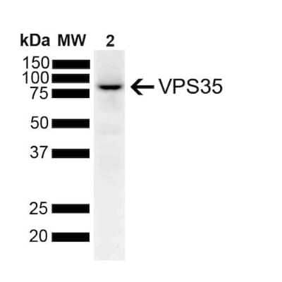 Western Blot: VPS35 Antibody (7E4) [NBP2-78823]