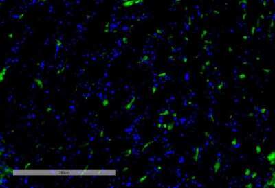 Immunohistochemistry: VPS35 Antibody (8A3) [NBP2-78825]