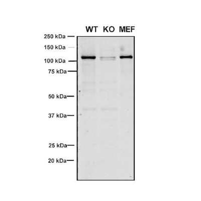 Western Blot: VPS35 Antibody (8A3) [NBP2-78825]