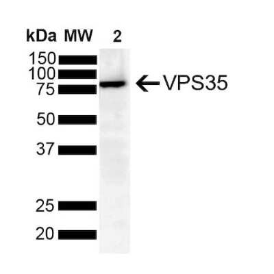 Western Blot: VPS35 Antibody (8A3) [NBP2-78825]