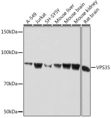 Western Blot: VPS35 Antibody (8D3L3) [NBP3-16803]