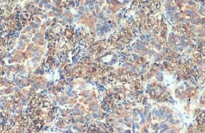Immunohistochemistry-Paraffin: VPS35 Antibody (HL1017) [NBP3-13680]
