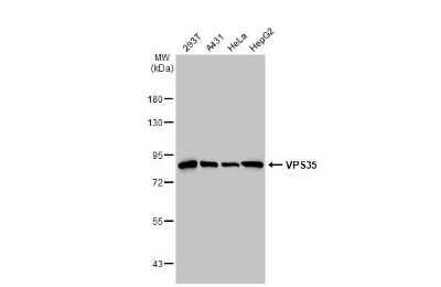 Western Blot: VPS35 Antibody (HL1017) [NBP3-13680]