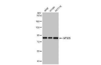 Western Blot: VPS35 Antibody (HL1017) [NBP3-13680]