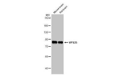 Western Blot: VPS35 Antibody (HL1017) [NBP3-13680]