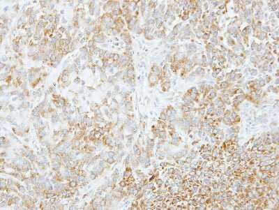 Immunohistochemistry-Paraffin: VPS35 Antibody [NBP2-20876]