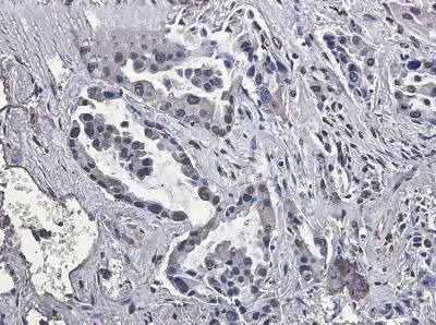 Immunohistochemistry-Paraffin: VPS35 Antibody (S03-6E1) [NBP3-19926]