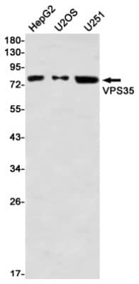 Western Blot: VPS35 Antibody (S03-6E1) [NBP3-19926]