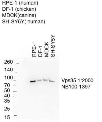 Western Blot: VPS35 Antibody [NB100-1397]