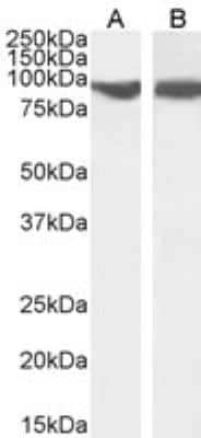 Western Blot: VPS35 Antibody [NB100-1397]