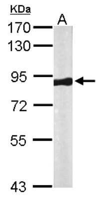 Western Blot: VPS35 Antibody [NBP1-31069]