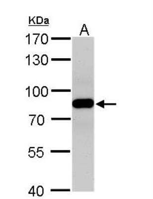 Western Blot: VPS35 Antibody [NBP1-31069]