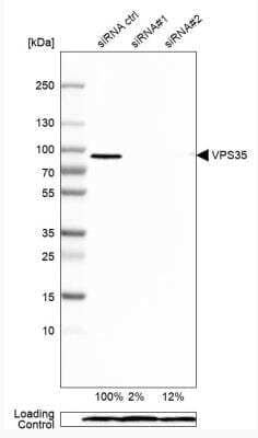 Western Blot: VPS35 Antibody [NBP2-13517]