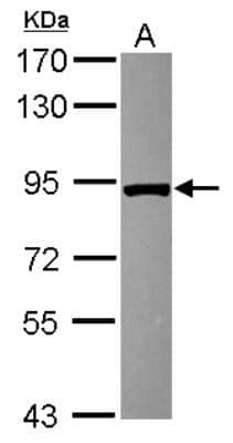 Western Blot: VPS35 Antibody [NBP2-20876]