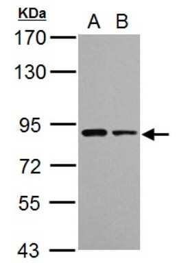 Western Blot: VPS35 Antibody [NBP2-20876]