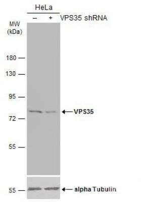 Western Blot: VPS35 Antibody [NBP2-20876]