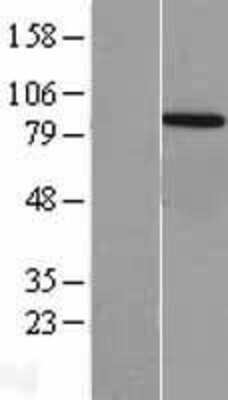 Western Blot: VPS35 Overexpression Lysate [NBL1-17746]