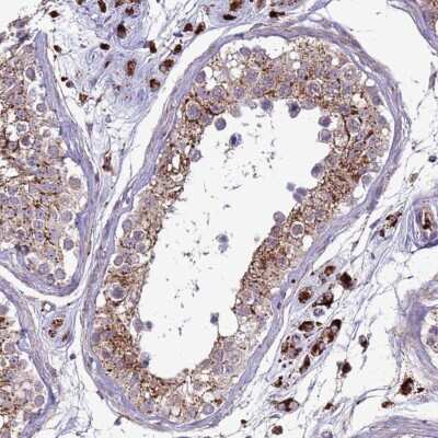 Immunohistochemistry-Paraffin: VPS36 Antibody [NBP2-13519]