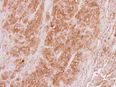 Immunohistochemistry-Paraffin: VPS36 Antibody [NBP2-20877]