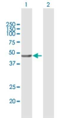 Western Blot: VPS36 Antibody [H00051028-B01P]