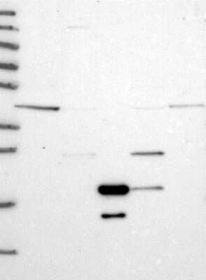 Western Blot: VPS36 Antibody [NBP2-13519]