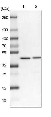 Western Blot: VPS36 Antibody [NBP2-13519]