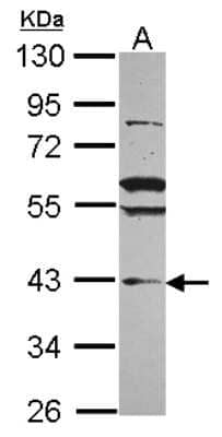 Western Blot: VPS36 Antibody [NBP2-20877]