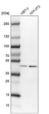 Western Blot: VPS37A Antibody [NBP1-83528]