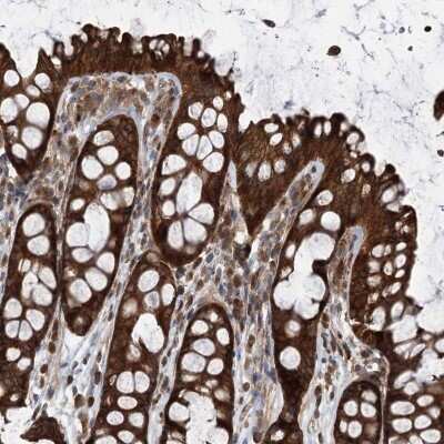 Immunohistochemistry-Paraffin: VPS37B Antibody [NBP1-82283]