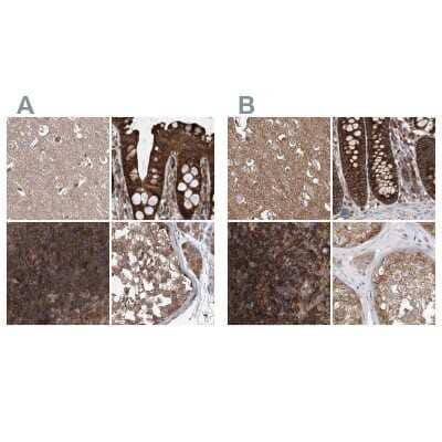 Immunohistochemistry-Paraffin: VPS37B Antibody [NBP1-82283]