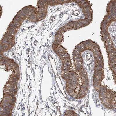 Immunohistochemistry-Paraffin: VPS37B Antibody [NBP1-82283]