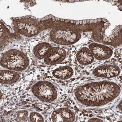 Immunohistochemistry-Paraffin: VPS37B Antibody [NBP1-82283]