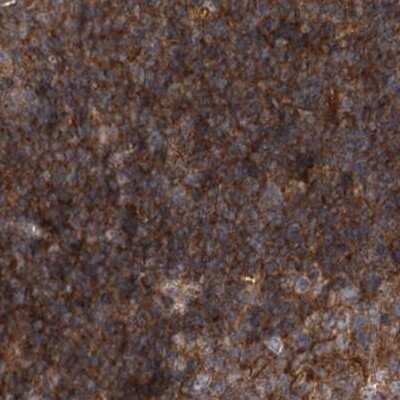 Immunohistochemistry-Paraffin: VPS37B Antibody [NBP1-82283]