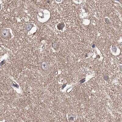 Immunohistochemistry-Paraffin: VPS37B Antibody [NBP1-82283]