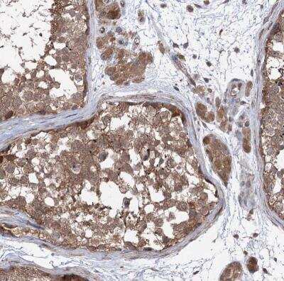 Immunohistochemistry-Paraffin: VPS37B Antibody [NBP1-82283]