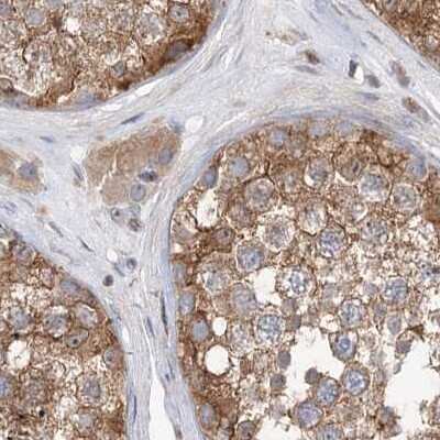 Immunohistochemistry-Paraffin: VPS37B Antibody [NBP2-38398]