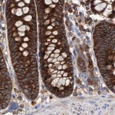 Immunohistochemistry-Paraffin: VPS37B Antibody [NBP2-38398]