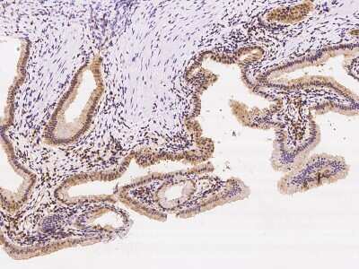 Immunohistochemistry-Paraffin: VPS37B Antibody [NBP3-06284]