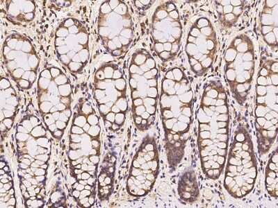 Immunohistochemistry-Paraffin: VPS37B Antibody [NBP3-06284]