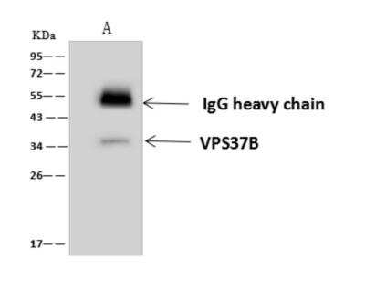 Immunoprecipitation: VPS37B Antibody [NBP3-06284]