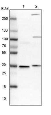 Western Blot: VPS37B Antibody [NBP1-82283]