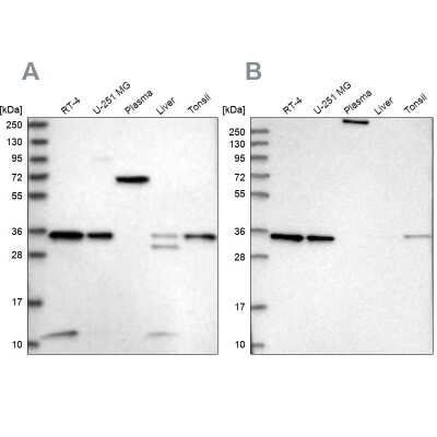 Western Blot: VPS37B Antibody [NBP1-82283]
