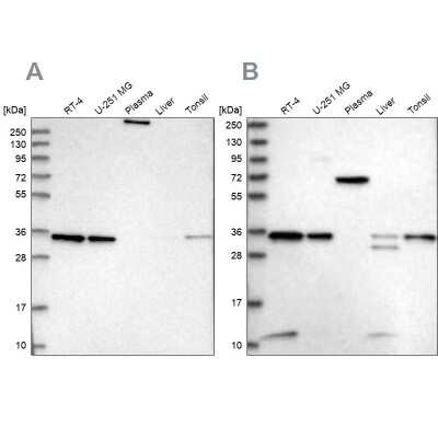 Western Blot: VPS37B Antibody [NBP2-38398]